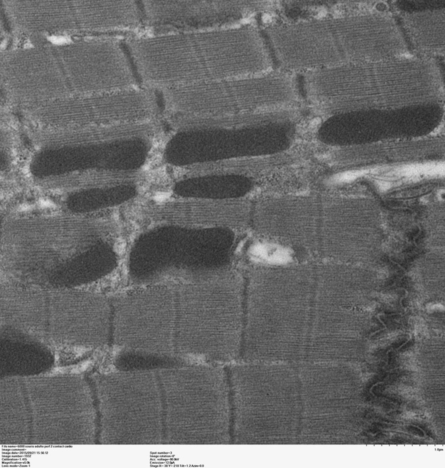 Coupe de cardiomyocytes en AFS - C. Guilbeau-Frugier - I2MC équipe 8