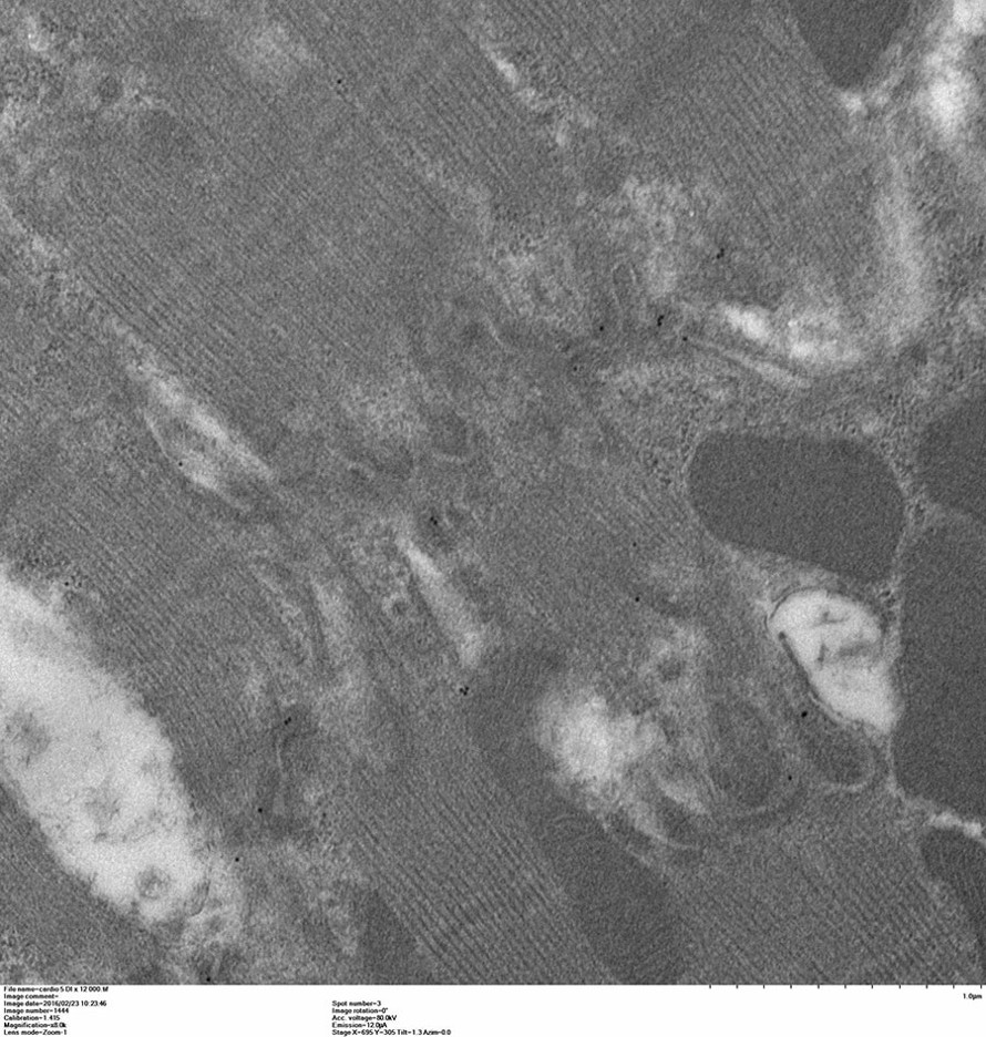 Marquage Claudine 5 sur disques intercalaires de cardiomyocytes - C. Guilbeau-Frugier - I2MC équipe 8