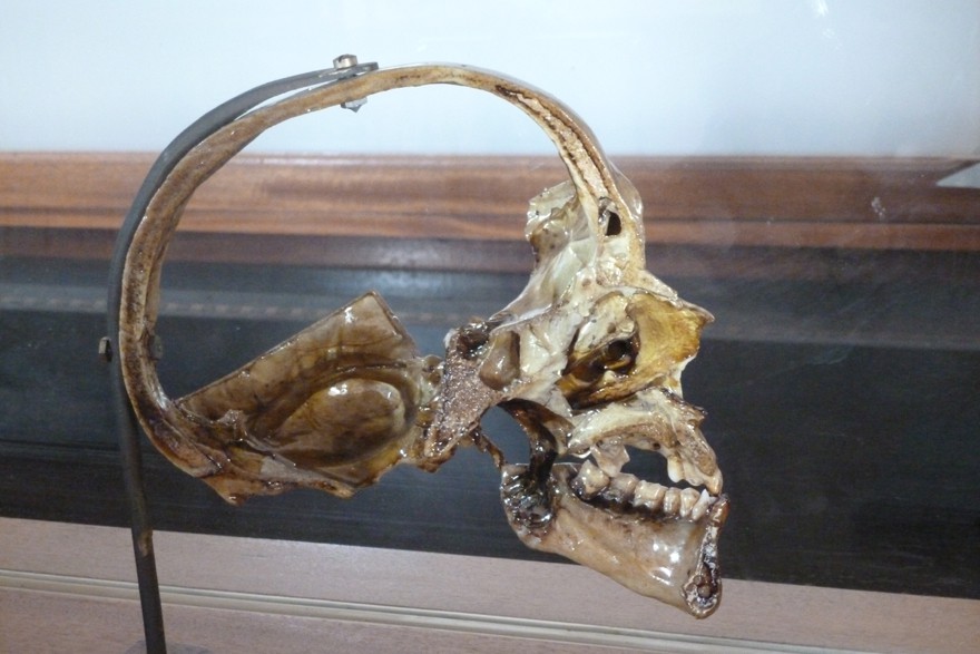 Coupe cranienne